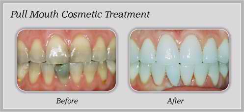 dental education about cosmetic treatment